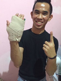 Gerry Salim cedera patah jari